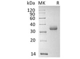 Recombinant Human CD2 Protein (His Tag)