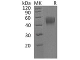 Recombinant Human IL10RB/IL10R2 Protein (His Tag)