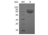 Recombinant Human IL13RA1 Protein (His Tag)(Active)