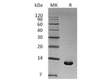 Recombinant Human S100A6 Protein (E.coli, His Tag)