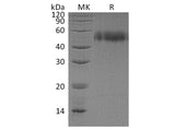 Recombinant Human uPAR Protein (His Tag)