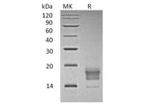 Recombinant Human TIGIT Protein (aa 22-141, His Tag)