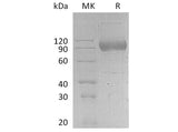 Recombinant Human IL17RA Protein (Fc Tag)(Active)