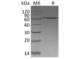 Recombinant Human P4HB Protein (His Tag)