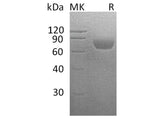 Recombinant Human CD48 Protein (His Tag)