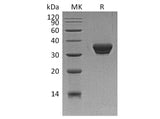 Recombinant Human ASAM Protein (His Tag)