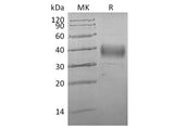 Recombinant Human ASGR1/ASGPR1 Protein (His Tag)