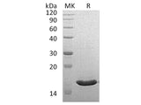 Recombinant Human VAPB Protein (His Tag)(Active)