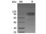 Recombinant Human IL2RG/CD132 Protein (aa 23-262, Fc Tag)