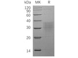 Recombinant Human BMPR2 Protein (His Tag)