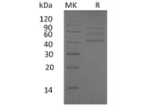 Recombinant Human RELT/TNFRSF19L Protein (Fc Tag)