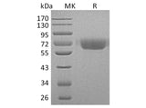 Recombinant Human Kininogen 1/KNG1 Protein (His Tag)