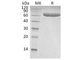 Recombinant Human LBP Protein (His Tag)