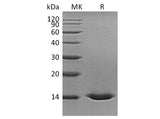 Recombinant Human Cystatin D Protein (His Tag)