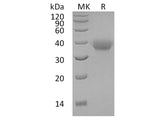 Recombinant Human OX40/TNFRSF4 Protein (His Tag)(Active)