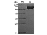 Recombinant Human Nogo Receptor/NgR Protein (His Tag)