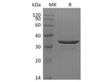 Recombinant Human ACYP2 Protein (GST Tag)