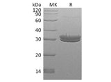 Recombinant Human Kallikrein 7/KLK7 Protein (His Tag)