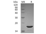 Recombinant Human TRAIL Protein (Active)