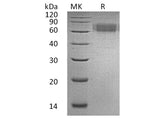 Recombinant Human IL6RA/CD126 Protein (His Tag) Purity >95%