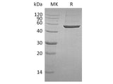 Recombinant Human PGD Protein (Human Cells, His Tag)