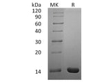 Recombinant Human Interleukin-2/IL-2 Protein (E.coli, Active)