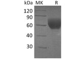 Recombinant Human TGFBR2 Protein (Fc Tag)