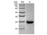 Recombinant Human RBP4 Protein 