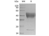 Recombinant Human IFNGR1 Protein (His Tag)