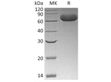 Recombinant Human GFRRA2 Protein (His Tag)