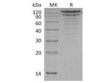 Recombinant Human LDLR Protein (His Tag)