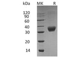 Recombinant Human Fas/CD95/TNFRSF6 Protein (His Tag)
