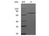 Recombinant Human HER3/ErbB3 Protein (Fc Tag)