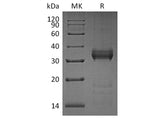 Recombinant Human Kallikrein 13/KLK13 Protein (His Tag)