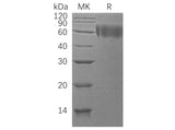 Recombinant Human DR6/TNFRSF21 Protein (His Tag)