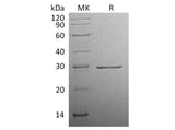 Recombinant Human Factor D Protein (His Tag)