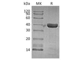 Recombinant Human Cathepsin Z Protein (His Tag)