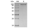 Recombinant Human Cadherin-6/CDH6 Protein (His Tag)