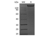 Recombinant Human FLT1 Protein (Fc Tag)