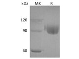 Recombinant Human PIGR Protein (His Tag)