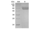 Recombinant Human IL1R1/CD121a Protein (His Tag)