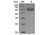 Recombinant Human IL1R2/CD121b Protein (His Tag)