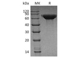 Recombinant Human CNDP1 Protein (His Tag)