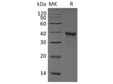 Recombinant Human Arginase-1/ARG1 Protein (His Tag)(Active)