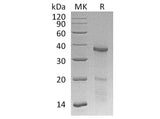 Recombinant Human HOXB4 Protein (His Tag) 