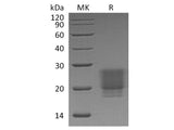 Recombinant Human/Mouse/Rat Irisin/FNDC5 Protein (His Tag)