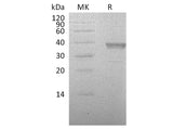 Recombinant Human HABP2 Protein (His Tag)