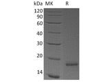 Recombinant Human CLDN18.2/Claudin-18 A2 Protein (His Tag)