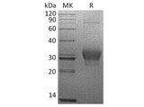 Recombinant Human CSN3/CASK Protein (His Tag)