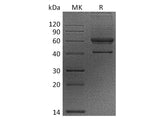 Recombinant Human VEGF-B/VEGFB Protein (Fc Tag)